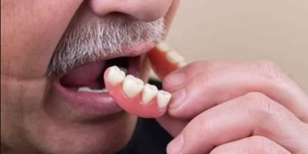 Auckland TMJ Specialist – Relief from Jaw Pain and Tension Headaches