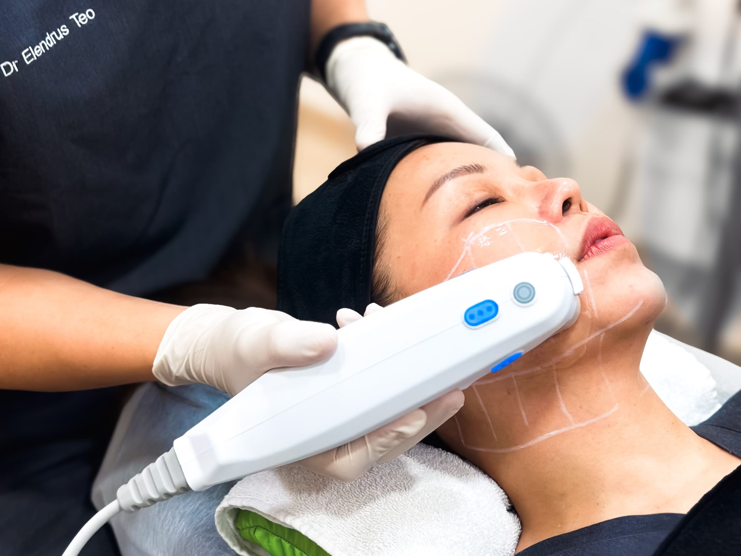 Ultherapy PRIME® Treatment - Non-Invasive Skin Lifting
