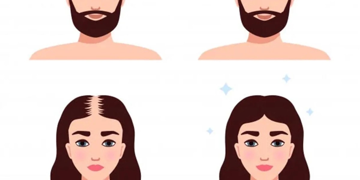 hair patch service hyderabad