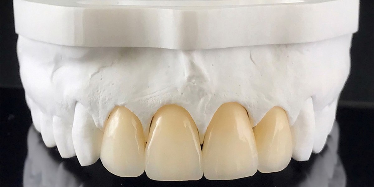 Zirconia Crown Dubai for Durable, Natural-Look Teeth