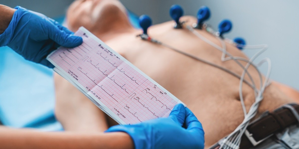 Choosing the Right Echocardiography Testing Centres in Bangalore: A Complete Patient Guide