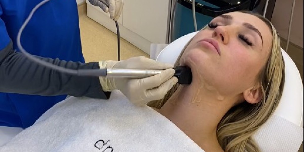 Morpheus8 for Aging Skin: What Experts Say