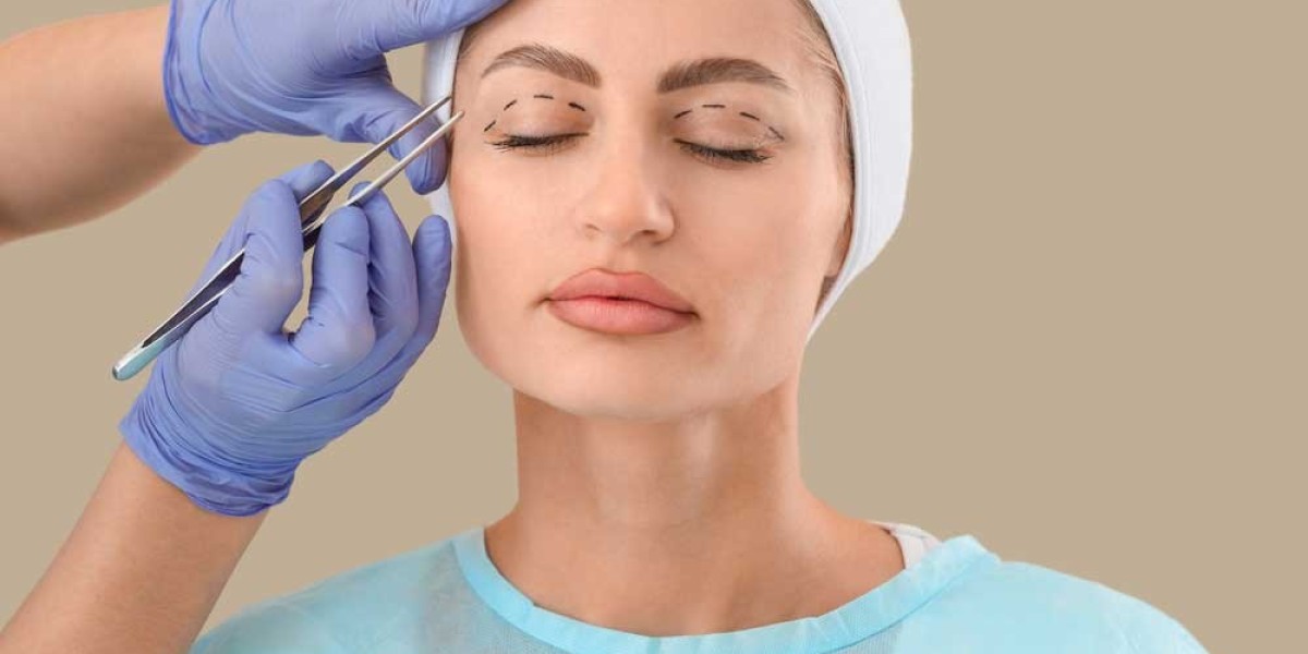 Eyelid Surgery for Droopy Eyelids: What You Should Expect