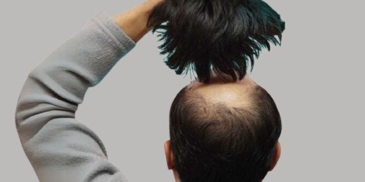 Soft and Lightweight Hair Wigs in Islamabad