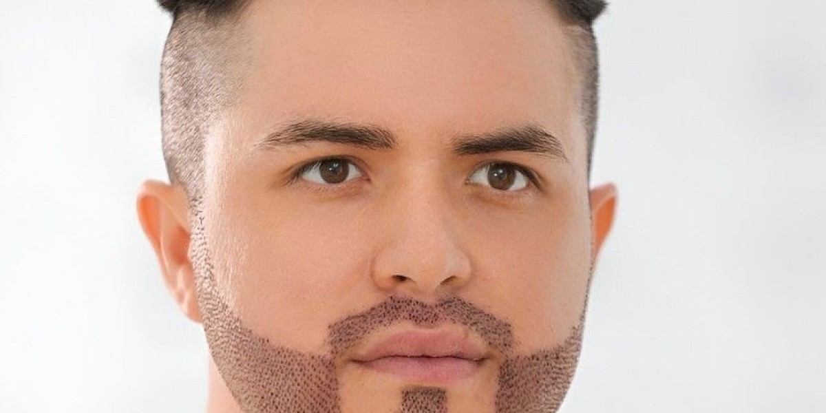 Advanced Techniques in Beard Hair Transplant