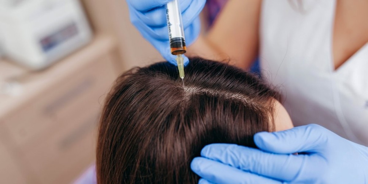 Understanding the Injection Process in the Best PRP Hair Treatment