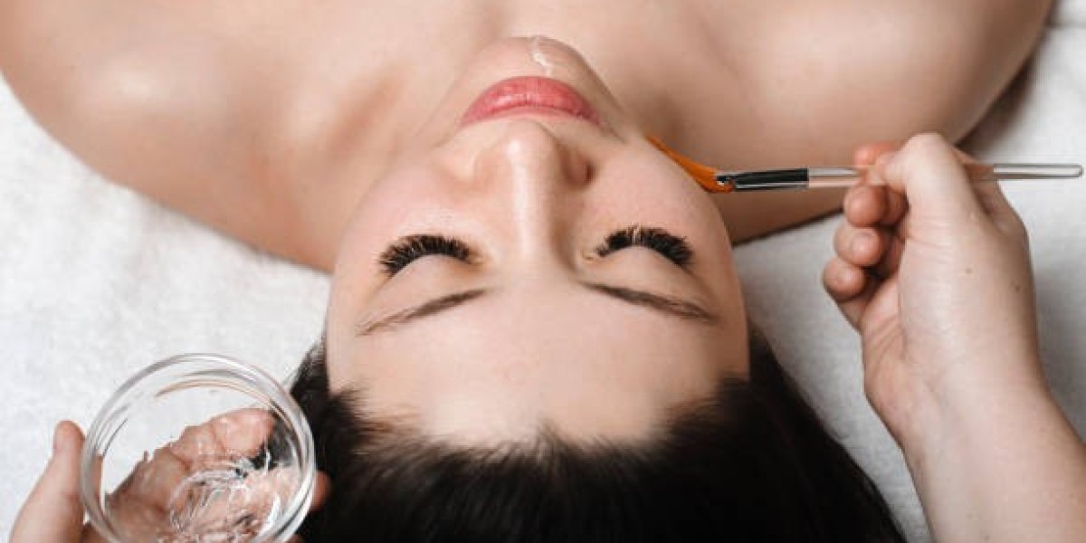 Chemical Peels in Riyadh: The Key to Smoother, Firmer Skin