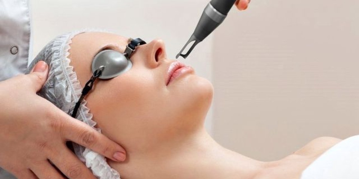 Precision Skincare: Why Laser Treatments Offer Targeted Results