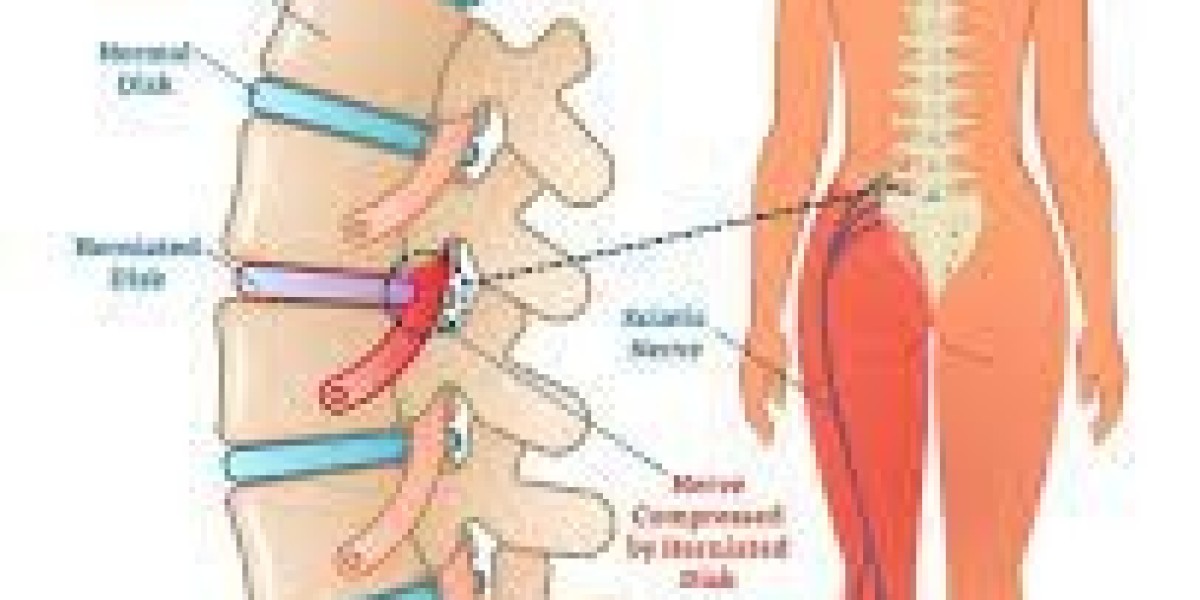 How Aspadol Tab 100 mg Compares to Opioid Painkillers | Full Expert Guide