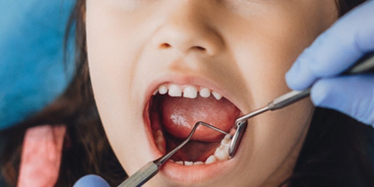 Emergency Dental Care for Children in Islamabad: Costs & Treatment Options