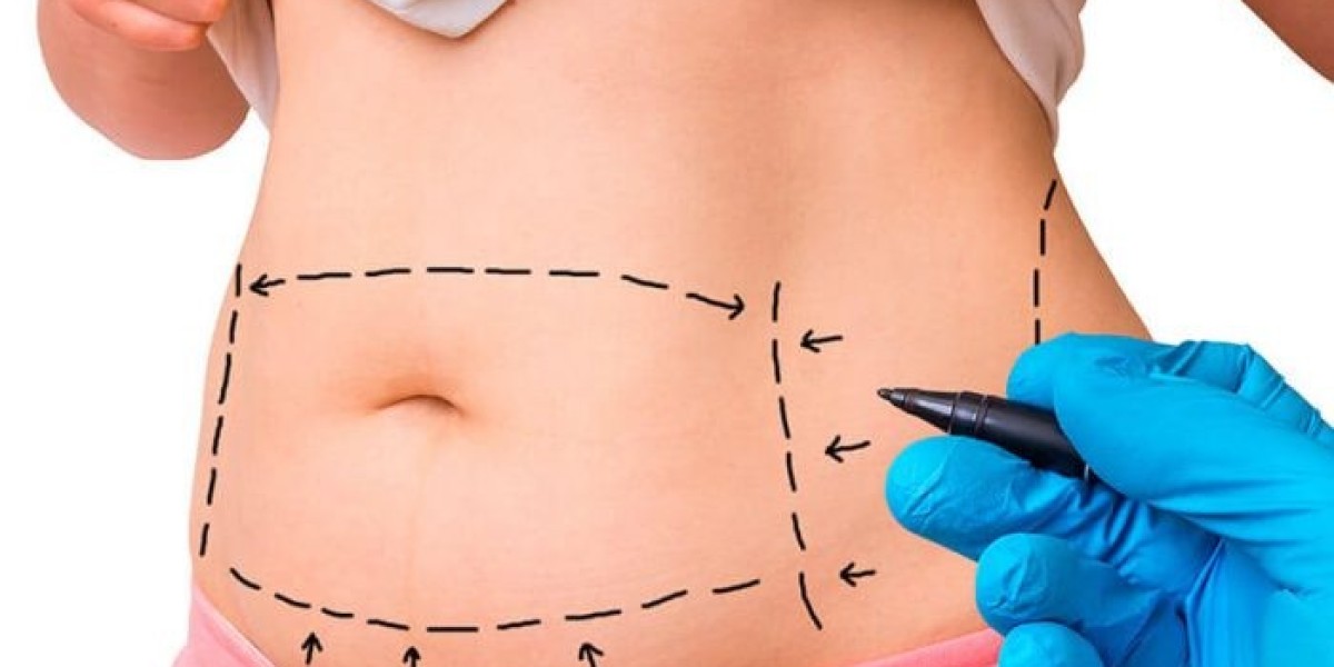 When Recovery Starts After Laser Liposuction in Dubai?