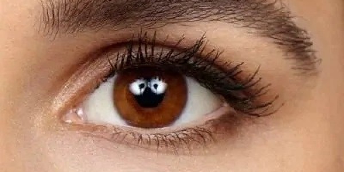 Common Myths About Brow Lift Surgery in Islamabad