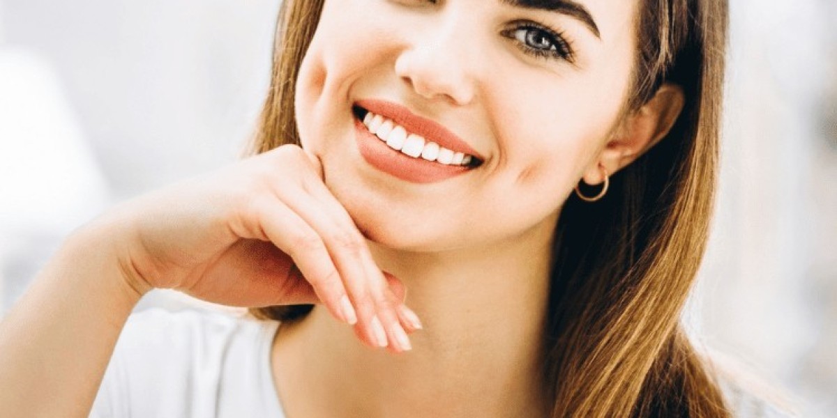 Hollywood Smile Cost: What Affects the Price?