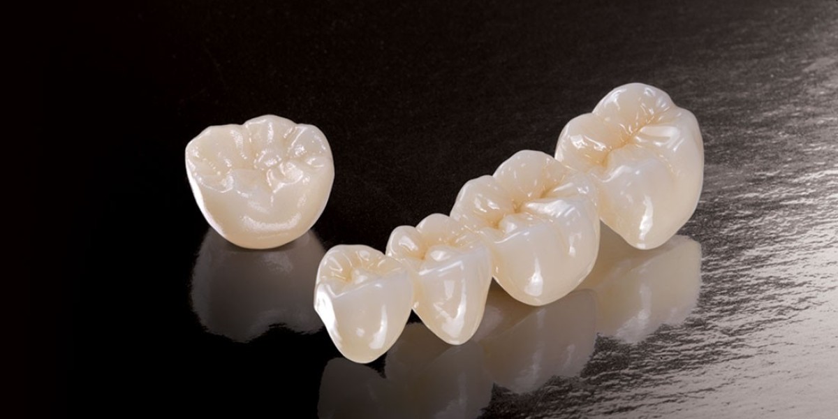 Protecting Dental Crowns and Bridges from Wear and Tear