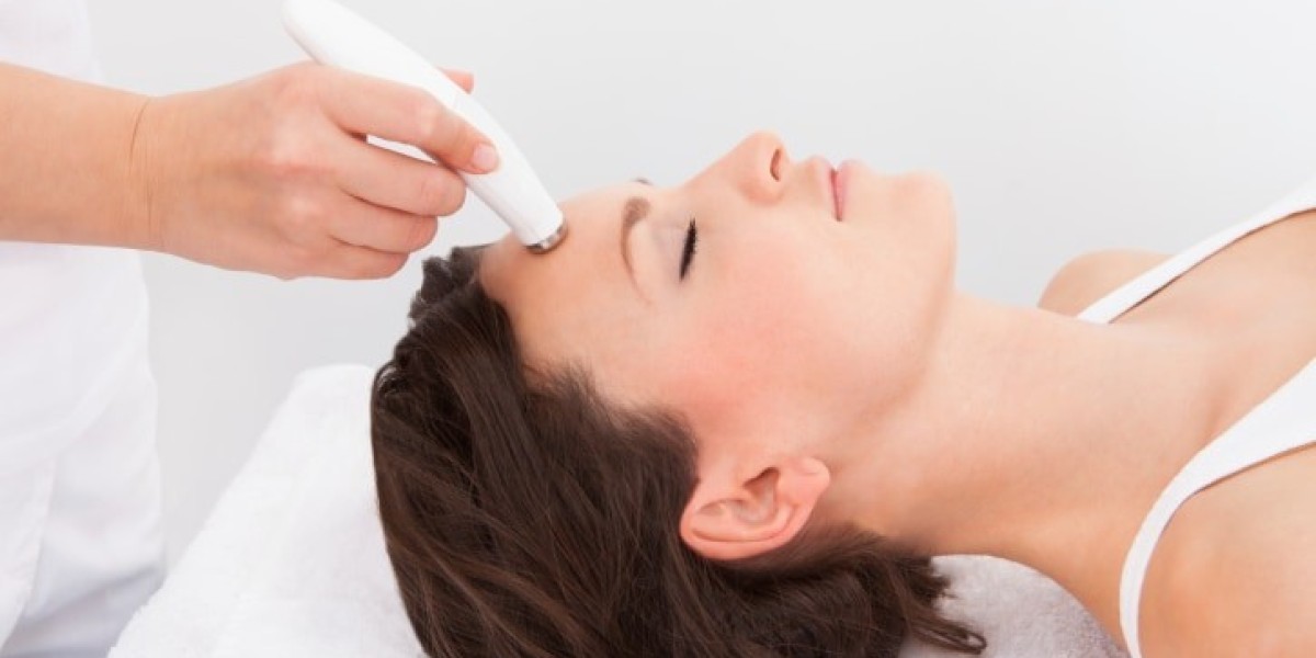 Face Laser Treatment Cost for Acne Scars: What to Expect