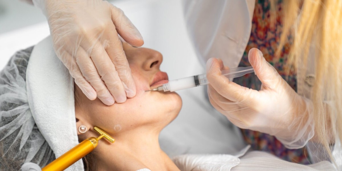 Sculptra Fillers in Dubai: Treatment Areas Explained