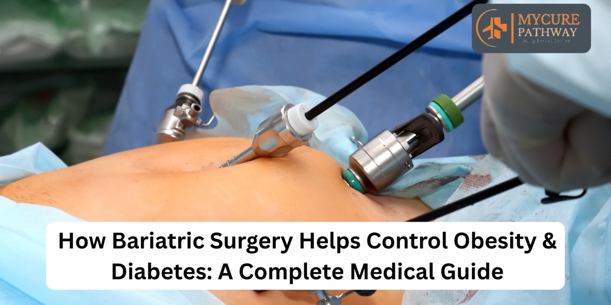 How Bariatric Surgery Helps Control Obesity & Diabetes: A Complete Medical Guide