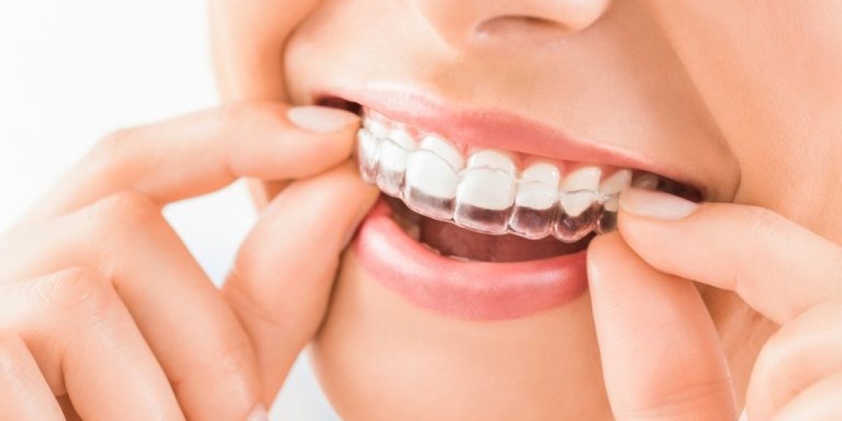 Invisalign Braces Dubai – Straighten Your Teeth Discreetly and Comfortably