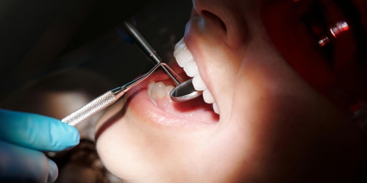 Teeth Whitening Cost in Dubai for Clear Expectations