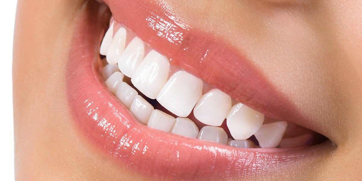 How Cavities Are Fixed With Modern Dental Care